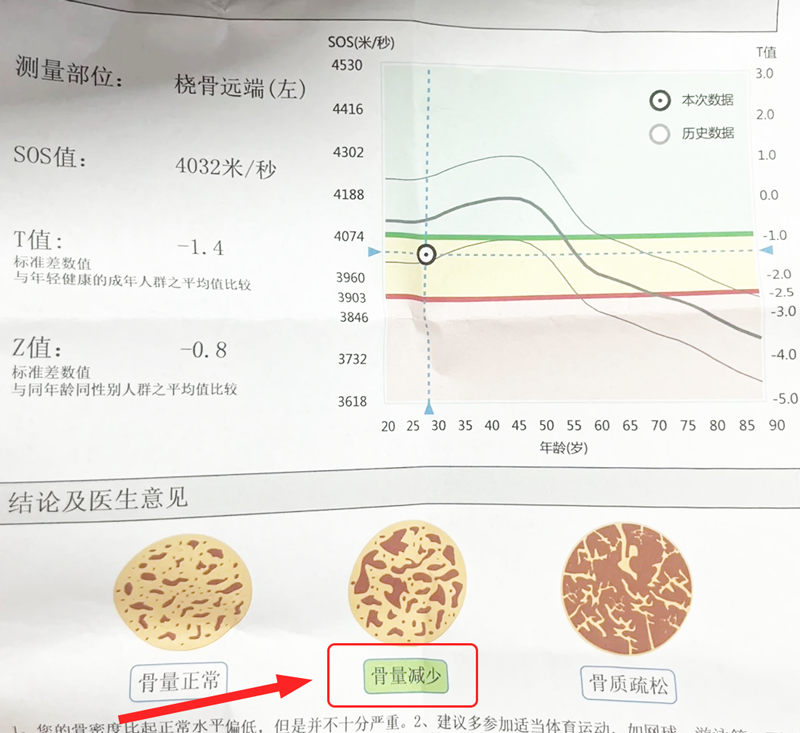 骨量減少診斷書.png 骨量減少診斷書.png